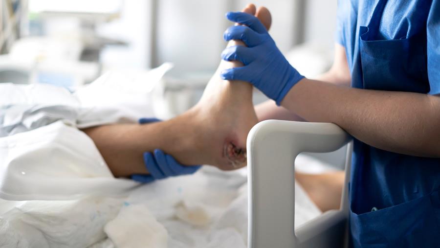 Nouvel outil pour évaluer le risque d’escarres chez les patients hospitalisés